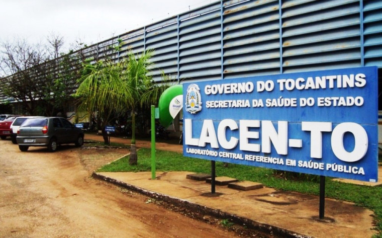 Laboratório Central de Saúde Pública do Tocantins (Lacen)