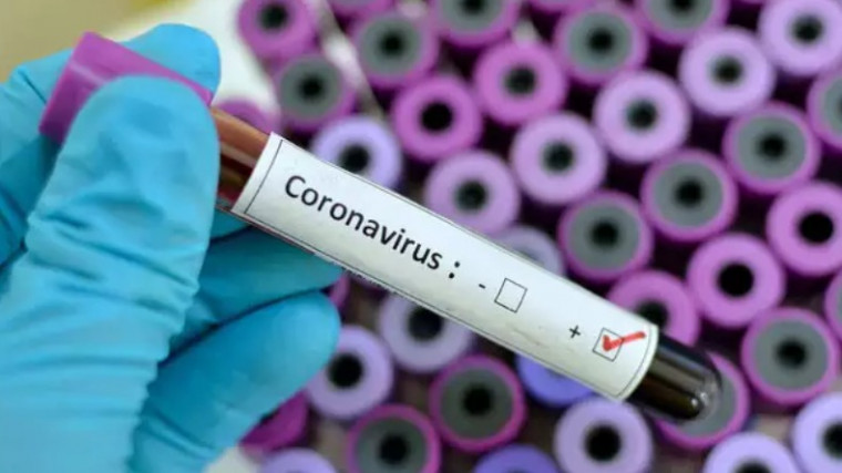 Coronavírus causa primeira morte no Brasil