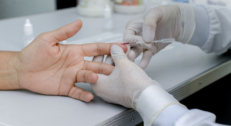 Usuários do SUS fazem teste rápido para diagnóstico das hepatites virais nas UBS