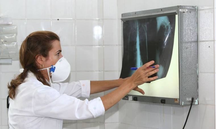 O Brasil ocupa o 17º lugar entre os 22 países responsáveis por 82% do total de casos de tuberculose