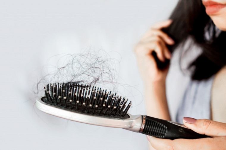 Queda de cabelo pode ser comum após infecção