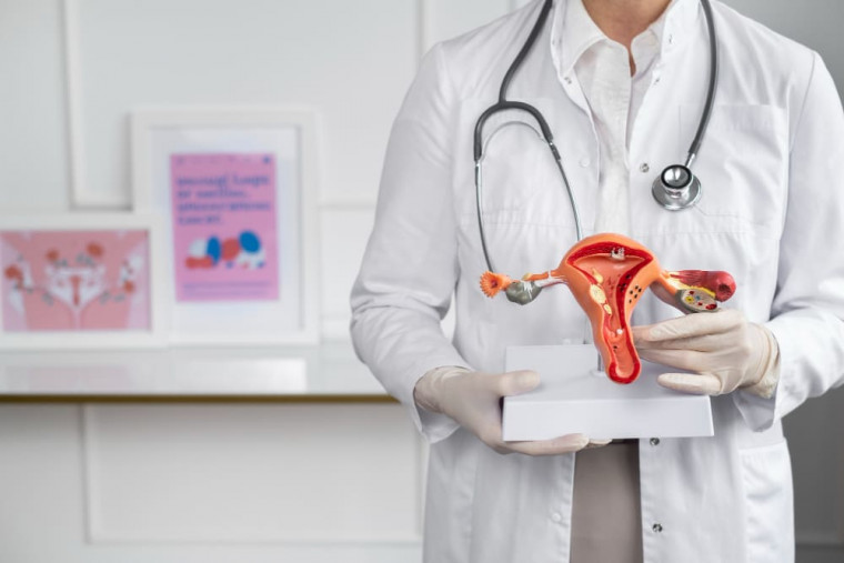 Endometriose: o que é, sintomas, tipos e tratamento