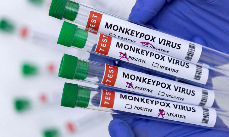 Teste de varíola dos macacos.
