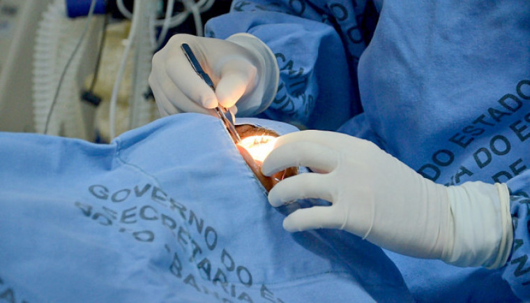Os transplantes de córneas, no Tocantins, são realizados no Hospital Geral de Palmas