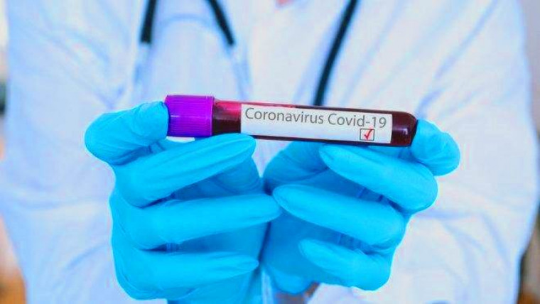 Teste de coronavírus
