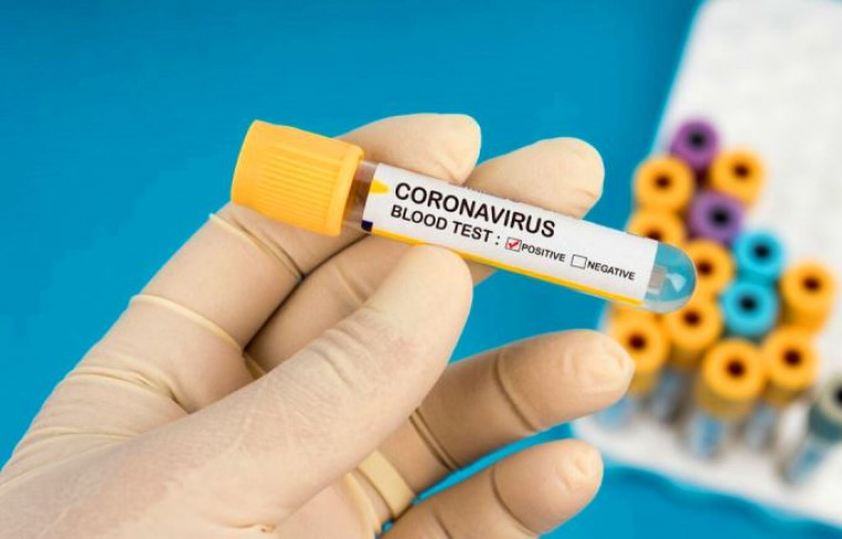 Teste de coronavírus