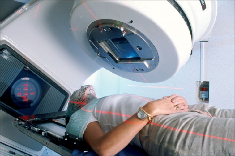 Veja as principais dúvidas da radioterapia