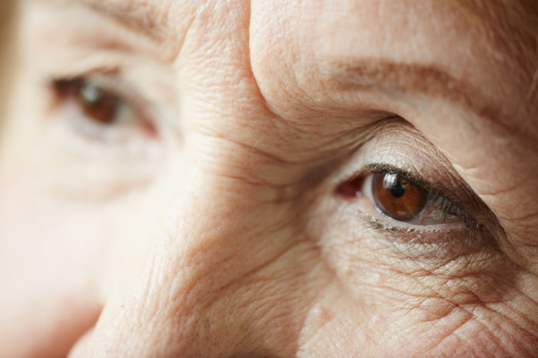 Doença nos olhos em idosos pode causar cegueira.