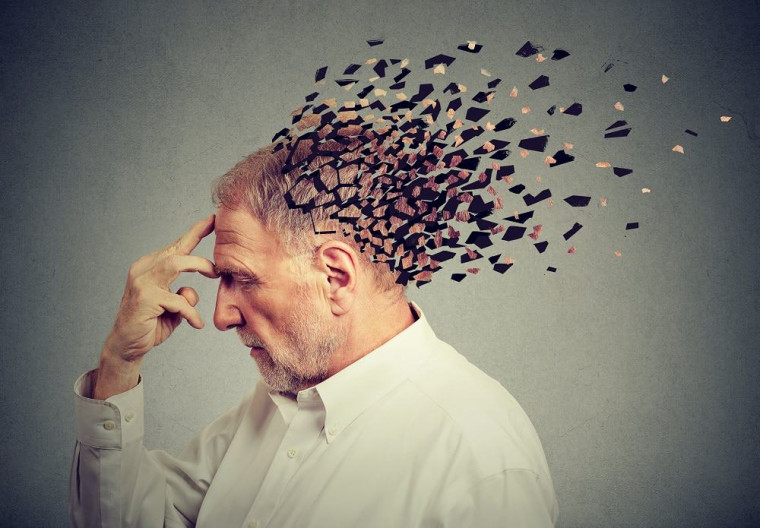 Doença de Alzheimer.