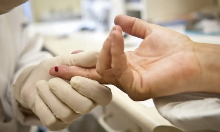 Teste rápido para HIV.